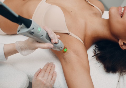 Laser Hair Removal